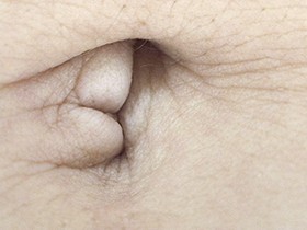 300人のへそ　サンプル画像01